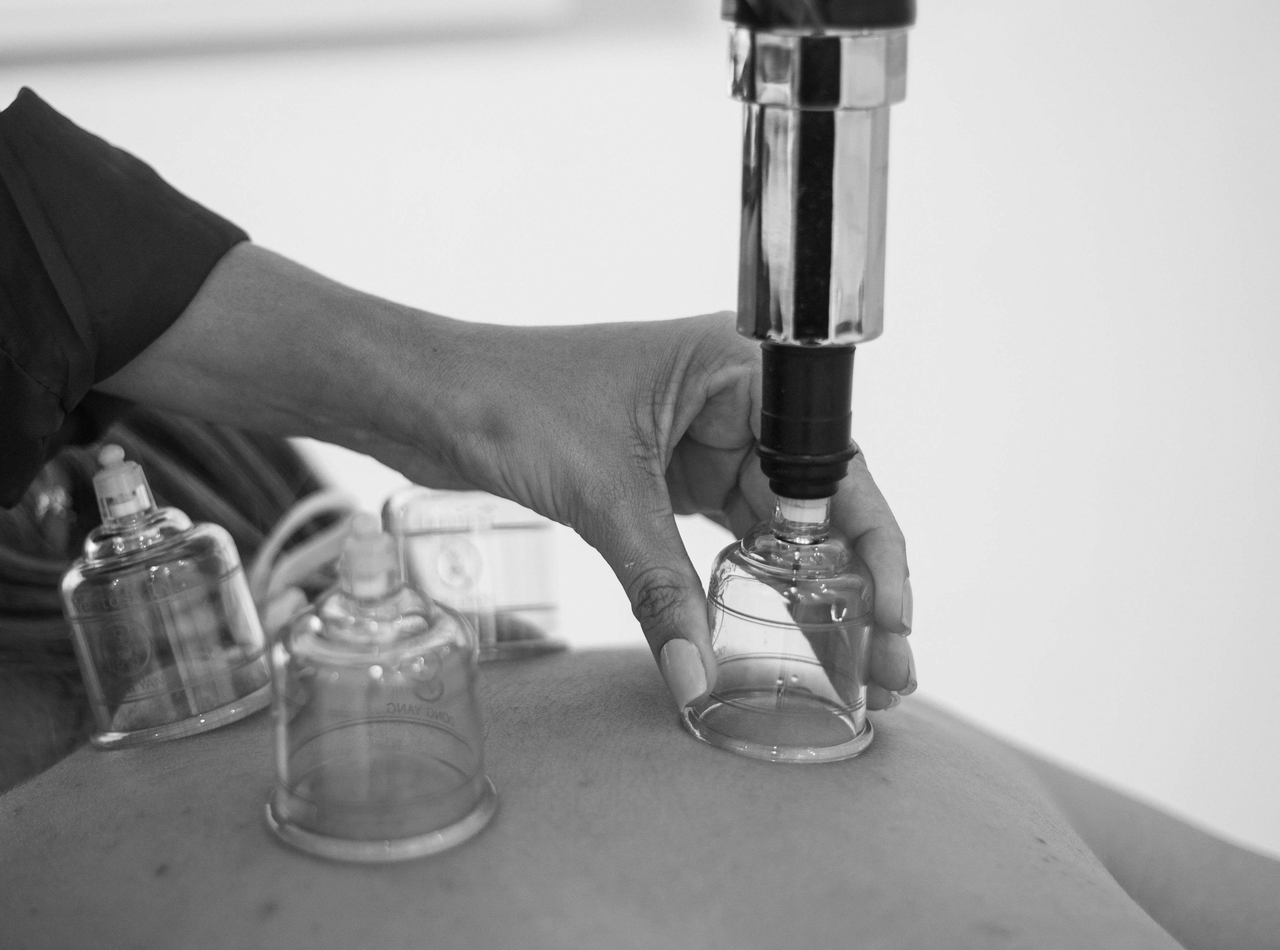 Air Cupping Treatment