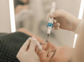 Skin Needling